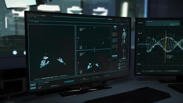 X-ray Interface Monitoring Health Condition Of Lungs Damaged By Covid Virus alt