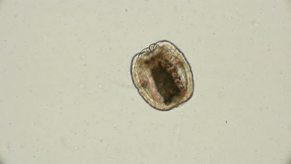 Egg, Cocoon of the Worm Tubifex Tubifex