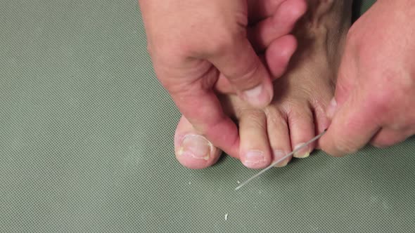 A Man's Hand Grinds a Fingernail on His Foot with a Metal File