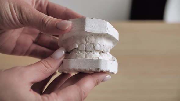 Gypsum Model Teeth Before Installing Bracket System