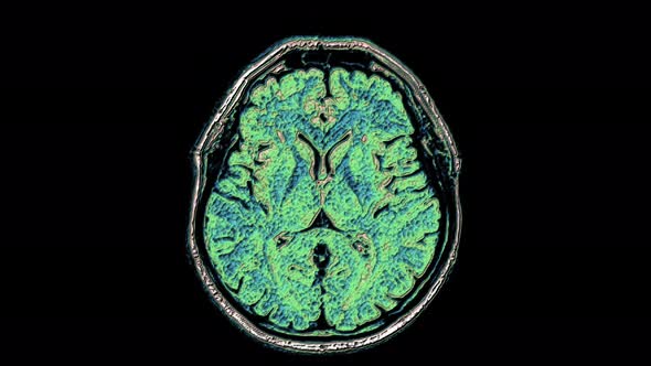 Bulk Multicolored MRI Scans of the Brain and Head To Detect Tumors. Diagnostic Medical Tool