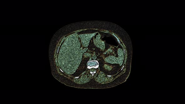 Bulk Multicolored MRI of the Abdominal Cavity, Gastrointestinal Tract, Bladder