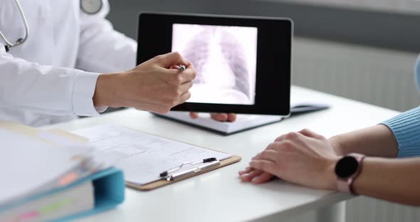 Doctor Showing Xray Image of Lungs to Patient on Digital Tablet  Movie Slow Motion
