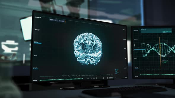 Computer Screen Displays Medical Program To Hold Patient Brain Diagnosis alt