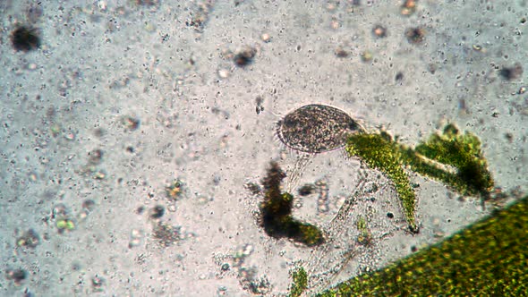 Vital Activity of Ciliate Stylonychia Mytilus in the Microcosm in the Microscope