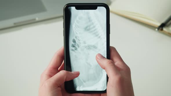 Doctor Veterinarian Examining Hedgehog Skeleton Roentgen Closeup