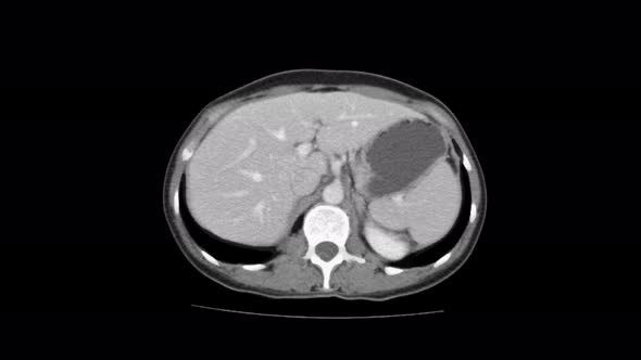 Contrast MRI of the Abdominal Cavity, Gastrointestinal Tract, Bladder