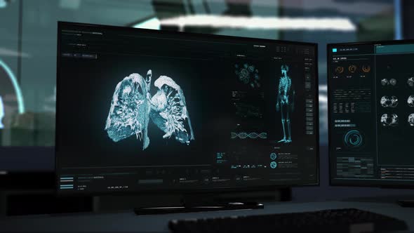 Futuristic diagnosis scanner studying the cancer cells in the patients lungs alt