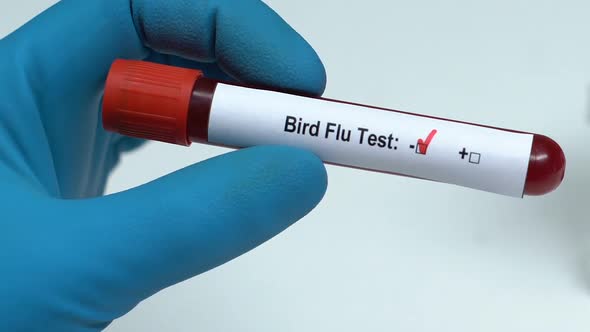 Bird Flu Test, Doctor Holding Blood Sample in Tube Close-Up, Health Check-Up