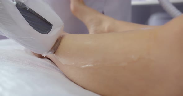 Laser Hair Removal Of Legs With The Help Of A Special Device. Beauty Salon. Beautician