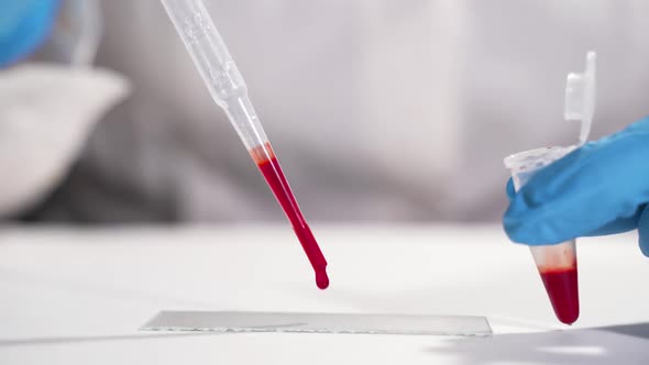 Close Up of the Glass Test Tube with a Blood in It in Hands in Medical Gloves of the Man or Woman