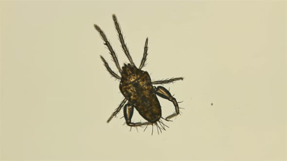 Tick Under the Microscope, Family Eupodoidea, Order Trombidiformes