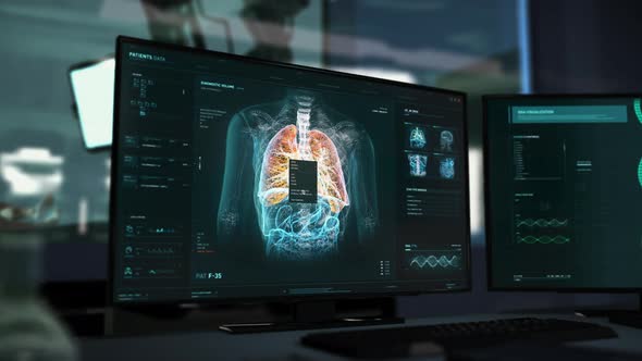 Computer Screen At Medical Laboratory Displays Advanced Diagnostics Software alt