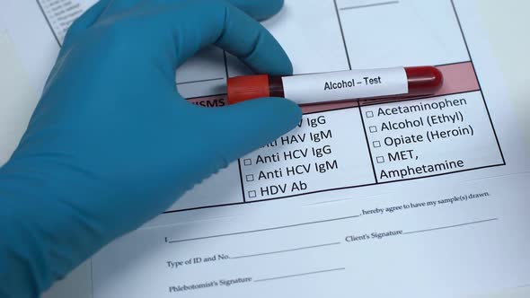 Alcohol, Doctor Checking Name in Lab Blank, Showing Blood Sample in Tube