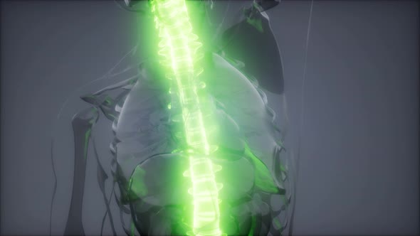 Backache in Back Bones alt