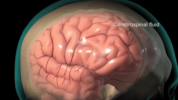 Cerebrospinal fluid is a clear, plasma-like fluid that bathes the central nervous system