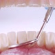 Dentist Inspects Teeth with Probe and Mirror - VideoHive Item for Sale