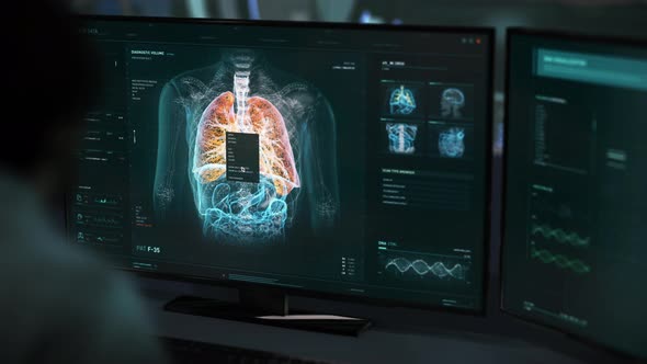 Lungs of the patient are being examined and diagnosed in the medical laboratory alt