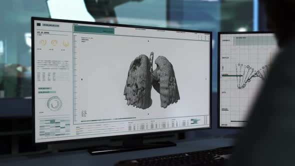 Chemistry Research Software Analysis Has Found Covid-19 Pneumonia in the Lungs