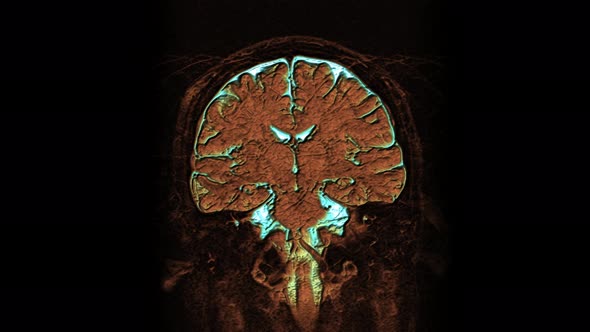 Bulk Multicolored MRI Scans of the Brain and Head To Detect Tumors. Diagnostic Medical Tool