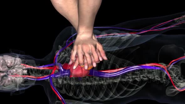 heart massage 3d medical animation