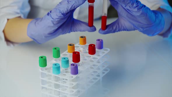 Technician holding blood tube sample. Hands of a lab technician with a tube of blood sample 