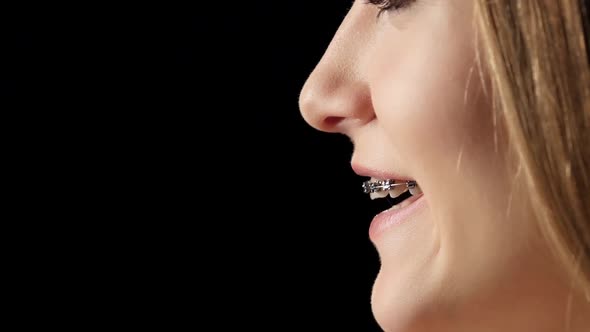 Girl in Profile with Braces Laughs. Black