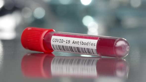 Covid-19 Coronavirus antibodies vial in medical lab