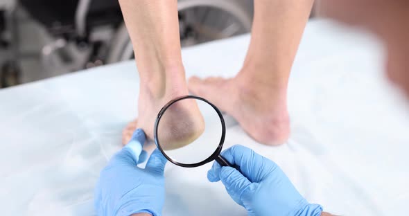 Dermatologist Conducts Physical Examination of Skin of Legs Through Magnifying Glass