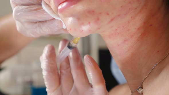 Cosmetologist Making Plasma Injections to Female Face and Neck