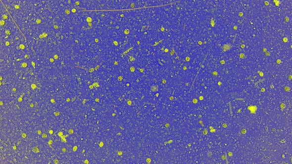 Small Life Microorganisms Such As Infusorias and Bacillus are Filmed in Macro alt