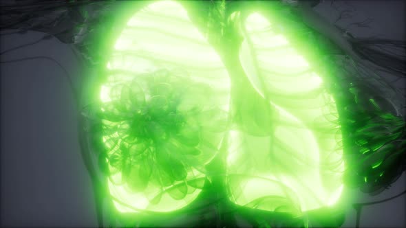 Human Lungs Radiology Exam alt