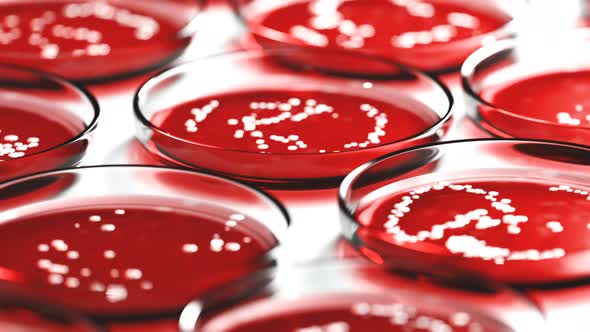 Petri dishes with red blood agar containing colonies of Staphylococcus aureus