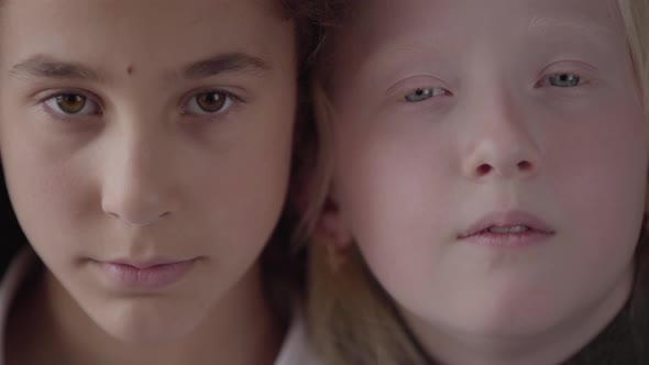 Close Up Portrait of Brunette Girl with Brown Eyes and Albino Girl with Grey Eyes