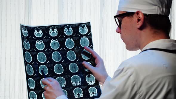 Doctor Examining Xray Magnetic Resonance Image of Head