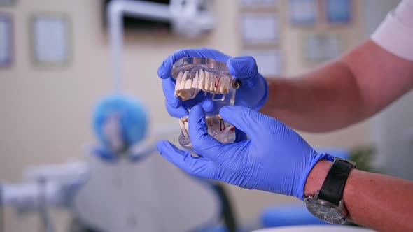 Doctor shows on a plastic jaw sample or model different methods of teeth treatment.