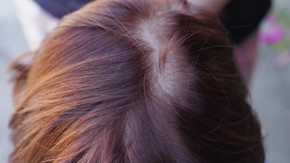 Woman with Hair Loss Problem