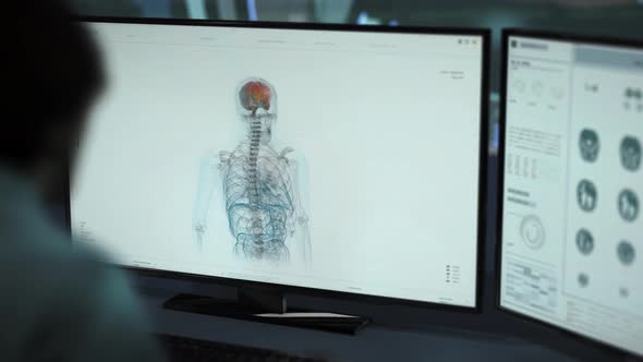 Interface of X-ray examination system scanning a brain is shown on the monitor alt