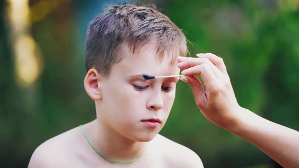 Boy has a open wound on the eyebrow. Mother gives the first aid to her child on face.