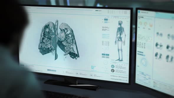 Medical Doctor Checks Patient Lung Cancer Diagnosis In A Computer Interface alt