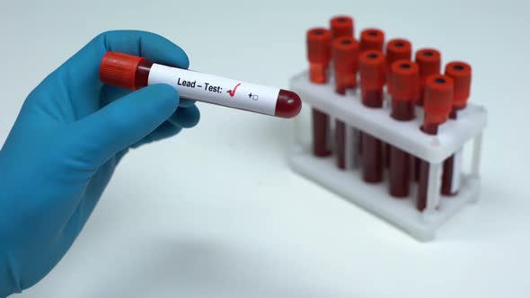 Negative Lead Test Doctor Showing Blood Sample, Lab Research, Health Check-Up