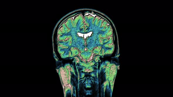 Bulk Multicolored MRI Scans of the Brain and Head To Detect Tumors. Diagnostic Medical Tool