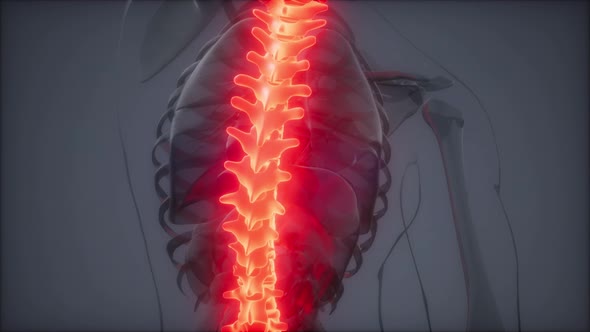 Backache in Back Bones alt