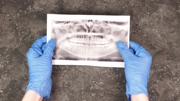 Dental x-ray