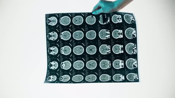 Xray Magnetic Resonance Image of Head