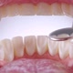 Dentist Inspects Teeth with Mirror - VideoHive Item for Sale