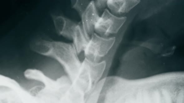 Neck Xray Closeup