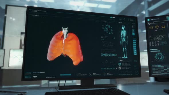 Futuristic Medical Interface Concludes Lungs Analysis With Covid Diagnosis alt