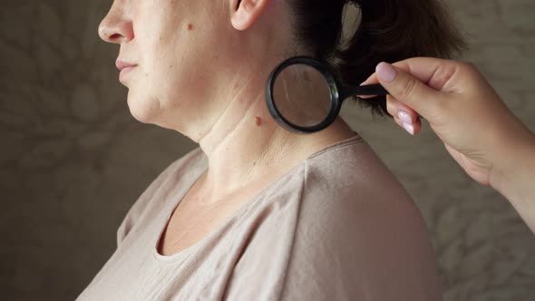 Dermatologist Examines a Mole on a Woman's Neck Using a Magnifying Glass