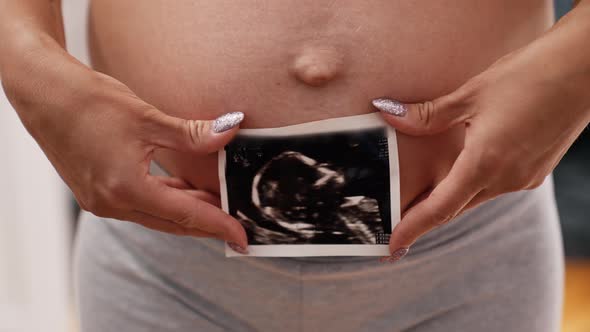 Pregnant Woman Holding an Ultrasound Scan in Front of Her Belly